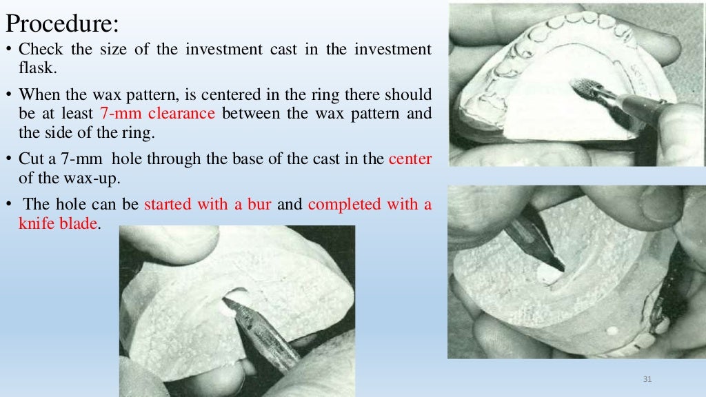 Casting Procedures & Casting Defects in Dentistry