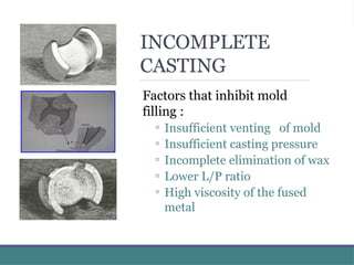 Casting procedures for dental students reference | PPTX