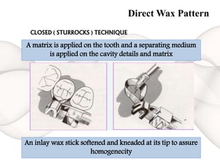 Direct Wax Pattern
A matrix is applied on the tooth and a separating medium
is applied on the cavity details and matrix
An inlay wax stick softened and kneaded at its tip to assure
homogenecity
CLOSED ( STURROCKS ) TECHNIQUE
 