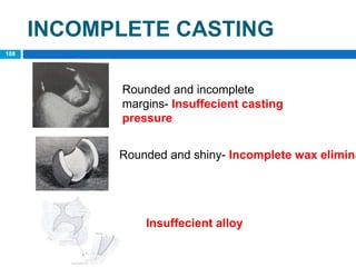 INCOMPLETE CASTING
Rounded and incomplete
margins- Insuffecient casting
pressure
Rounded and shiny- Incomplete wax elimina
108
Insuffecient alloy
 