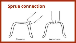 Dental Casting Procedures - Dental Materials | PPTX