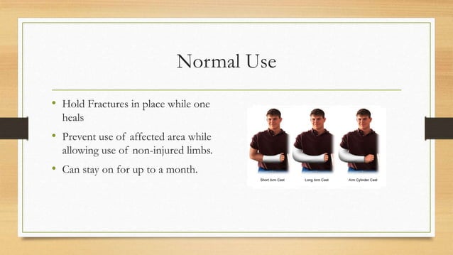 Casting splinting and bracing for wounds | PPT