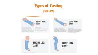 Casting and Splinting presentation for orthopedic residency | PDF