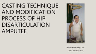 CASTING TECHNIQUE
AND MODIFICATION
PROCESS OF HIP
DISARTICULATION
AMPUTEE
-RUSHIKESH RAJGUDE
BPO, MGMIUDPO
 
