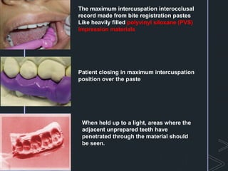 CAST METAL RESTORATIONS IN PROSTHODONTICS.pptx