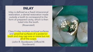 Inlay R1 Tooth CAST_METAL_RESTORATIONS fixed prosthetics .pdf