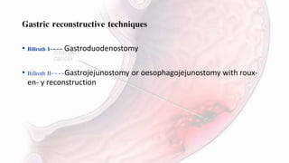 Gastric Carcinoma | PPTX