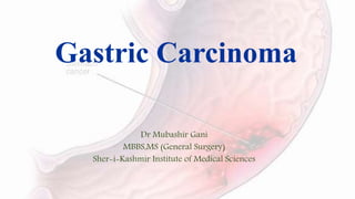Gastric Carcinoma
Dr Mubashir Gani
MBBS,MS (General Surgery)
Sher-i-Kashmir Institute of Medical Sciences
 