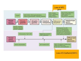 Loss of APC
gene
Loss of E-Cadherin(CDH1)
 