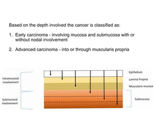 Based on the depth involved the cancer is classified as:
1. Early carcinoma - involving mucosa and submucosa with or
without nodal involvement
2. Advanced carcinoma - into or through muscularis propria
 