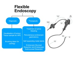 Flexible
Endoscopy
Diagnostic Therapeutic
Treatment of active
bleeding
Percutaneous endoscopic
gastrostomy
Self expanding metal stents
Endoscopic Mucosal
Resection and Endoscopic
Submucosal Dissection
Visualisation of tumour
Tissue sample for HPE
Brushing taken for
cytology
 