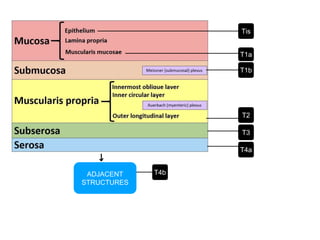 ADJACENT
STRUCTURES
Tis
T1a
T4b
T4a
T3
T1b
T2
 