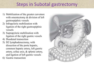 Steps in Subotal gastrectomy
1) Mobilization of the greater curvature
with omentectomy & division of left
gastroepiploic vessels
2) lnfrapyloric mobilization with
ligation of the right gastroepiploic
vessels
3) Suprapyloric mobilization with
ligation of the right gastric vessels
4) Duodenal transection
5) D2 lymphadenectomy, with
dissection of the porta hepatis,
common hepatic artery, left gastric
artery, celiac axis, & splenic artery,
and ligation of left gastric vessels
6) Gastric transection
 