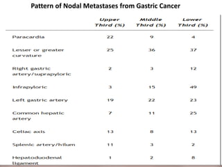 Pattern of Nodal Metastases from Gastric Cancer
 