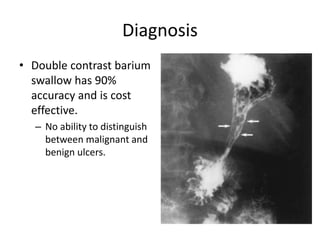 Diagnosis
• Double contrast barium
swallow has 90%
accuracy and is cost
effective.
– No ability to distinguish
between malignant and
benign ulcers.
 