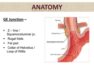 GE Junction –
 Z – line /
Squamocolumnar jn.
 Rugal folds
 Fat pad
 Collar of Helvetius /
Loop of Willis
 
