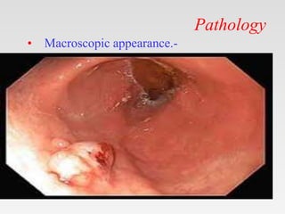 Pathology
• Macroscopic appearance.-
 