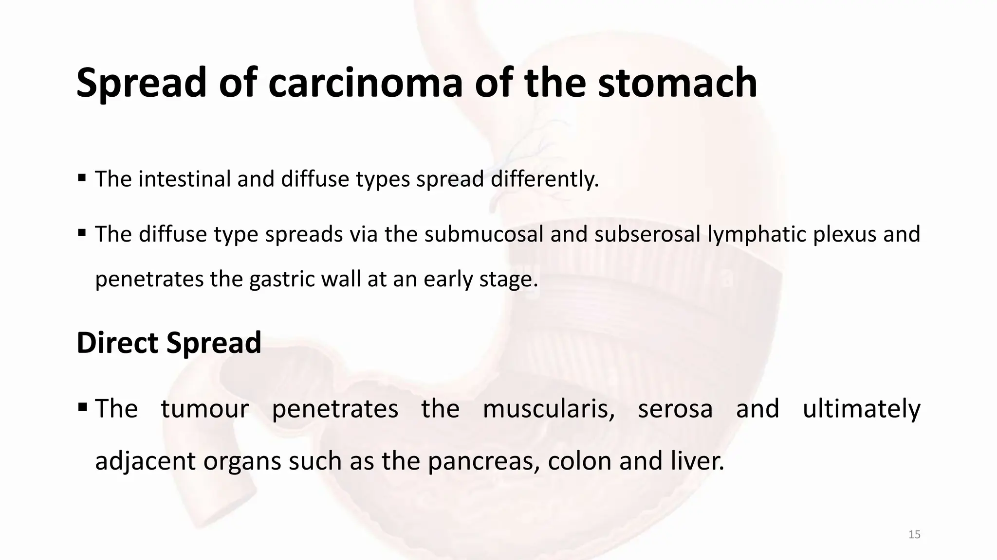 Carcinoma of Stomach ref on Bailey and Love (Seminar).pptx