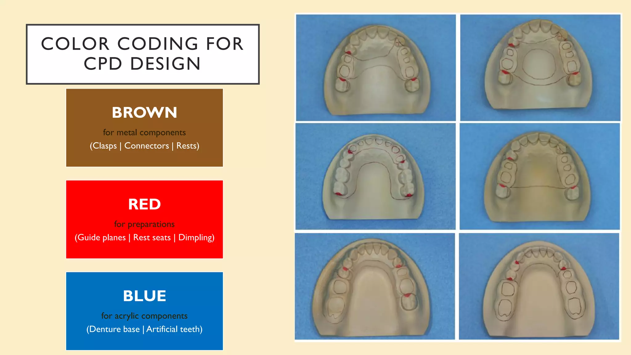 COLOR CODING FOR
CPD DESIGN
BROWN
for metal components
(Clasps | Connectors | Rests)
RED
for preparations
(Guide planes | Rest seats | Dimpling)
BLUE
for acrylic components
(Denture base | Artificial teeth)
 