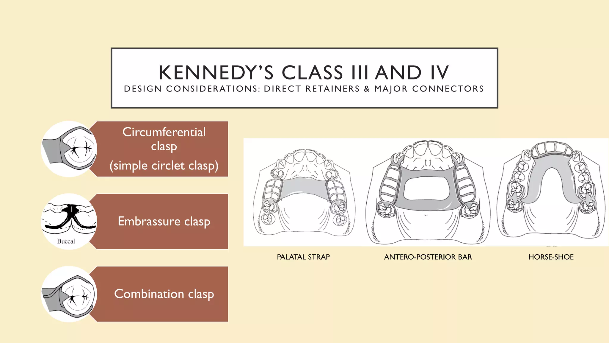 KENNEDY’S CLASS III AND IV
DESIGN CONSIDERATIONS: DIRECT RETAINERS & MAJOR CONNECTORS
Circumferential
clasp
(simple circlet clasp)
Embrassure clasp
Combination clasp
PALATAL STRAP ANTERO-POSTERIOR BAR HORSE-SHOE
 