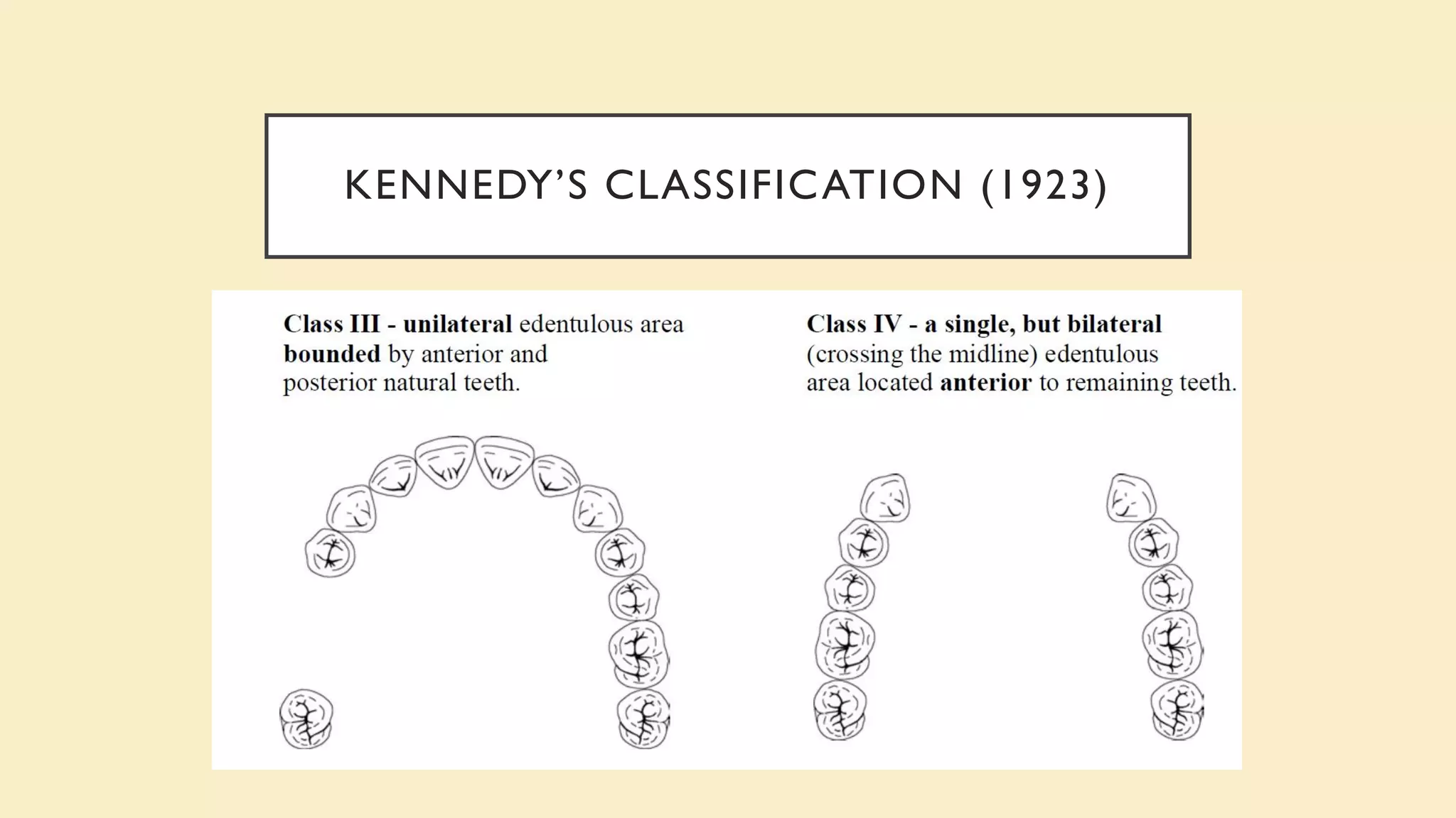 KENNEDY’S CLASSIFICATION (1923)
 