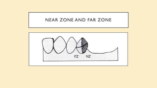 NEAR ZONE AND FAR ZONE
 