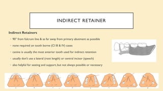 INDIRECT RETAINER
Indirect Retainers
◦ 90° from fulcrum line & as far away from primary abutment as possible
◦ none required on tooth borne (Cl III & IV) cases
◦ canine is usually the most anterior tooth used for indirect retention
◦ usually don’t use a lateral (root length) or central incisor (speech)
◦ also helpful for seating and support, but not always possible or necessary
 