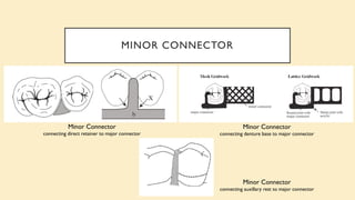 MINOR CONNECTOR
Minor Connector
connecting direct retainer to major connector
Minor Connector
connecting denture base to major connector
Minor Connector
connecting auxillary rest to major connector
 