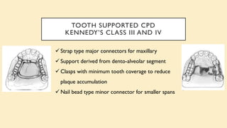 TOOTH SUPPORTED CPD
KENNEDY’S CLASS III AND IV
✓ Strap type major connectors for maxillary
✓ Support derived from dento-alveolar segment
✓ Clasps with minimum tooth coverage to reduce
plaque accumulation
✓ Nail bead type minor connector for smaller spans
 