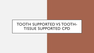 TOOTH SUPPORTED VS TOOTH-
TISSUE SUPPORTED CPD
 