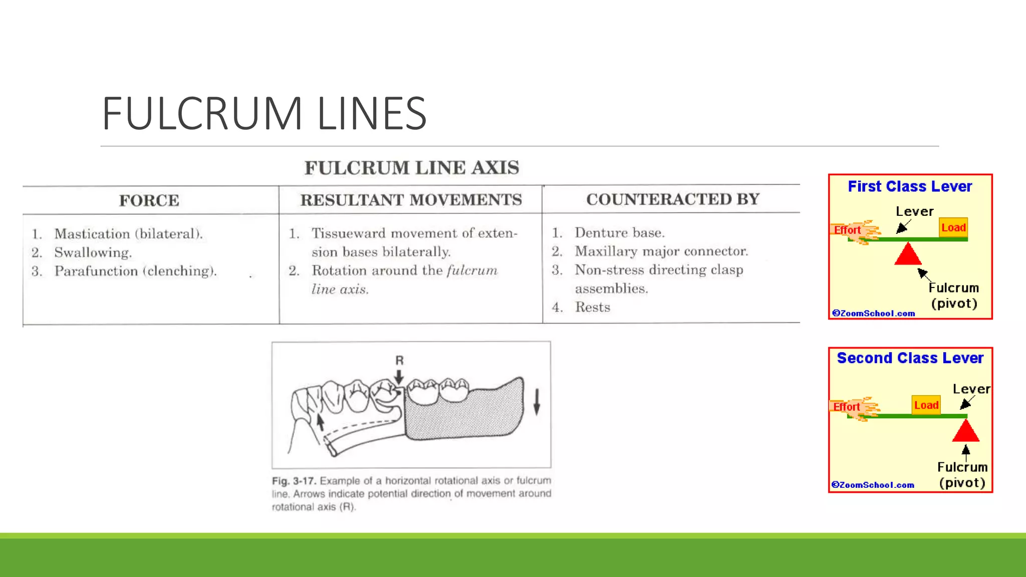 BASIC PRINCIPLES AND FUNDAMENTALS OF CAST PARTIAL DENTURE DESIGNING | PPTX