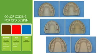 BASIC PRINCIPLES AND FUNDAMENTALS OF CAST PARTIAL DENTURE DESIGNING | PPTX