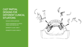 BASIC PRINCIPLES AND FUNDAMENTALS OF CAST PARTIAL DENTURE DESIGNING | PPTX
