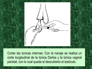Cortar las túnicas internas: Con la navaja se realiza un corte longitudinal de la túnica Dartos y la túnica vaginal parietal, con lo cual queda al descubierto el testículo.  