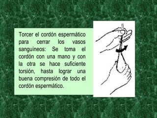 Torcer el cordón espermático para cerrar los vasos sanguíneos: Se toma el cordón con una mano y con la otra se hace suficiente torsión, hasta lograr una buena compresión de todo el cordón espermático.  