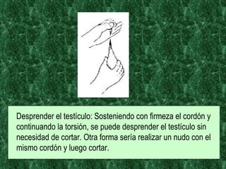 Desprender el testículo: Sosteniendo con firmeza el cordón y continuando la torsión, se puede desprender el testículo sin necesidad de cortar. Otra forma sería realizar un nudo con el mismo cordón y luego cortar.  