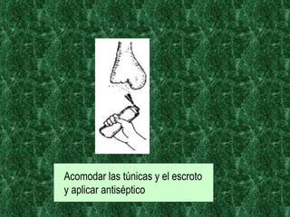 Acomodar las túnicas y el escroto y aplicar antiséptico   
