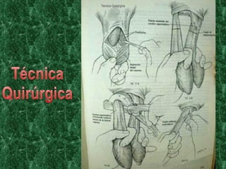 Técnica Quirúrgica 