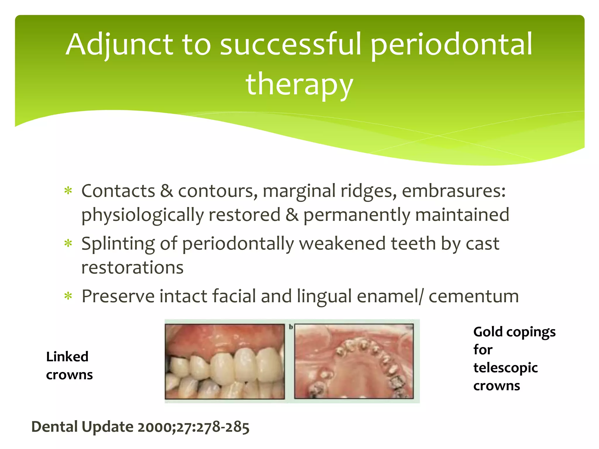 Cast restorations | PPTX