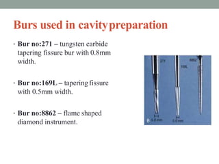 Burs used in cavitypreparation
• Bur no:271 – tungsten carbide
tapering fissure bur with 0.8mm
width.
• Bur no:169L – taperingfissure
with 0.5mm width.
• Bur no:8862 – flame shaped
diamond instrument.
 