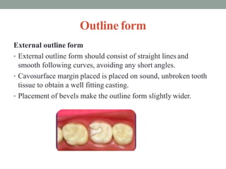 Outline form
External outline form
• External outline form should consist of straight lines and
smooth following curves, avoiding any short angles.
• Cavosurface margin placed is placed on sound, unbroken tooth
tissue to obtain a well fitting casting.
• Placement of bevels make the outline form slightly wider.
 