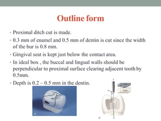 Outline form
• Proximal ditch cut is made.
• 0.3 mm of enamel and 0.5 mm of dentin is cut since the width
of the bur is 0.8 mm.
• Gingival seat is kept just below the contact area.
• In ideal box , the buccal and lingual walls should be
perpendicular to proximal surface clearing adjacent tooth by
0.5mm.
• Depth is 0.2 – 0.5 mm in the dentin.
 