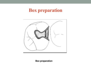 Box preparation
 