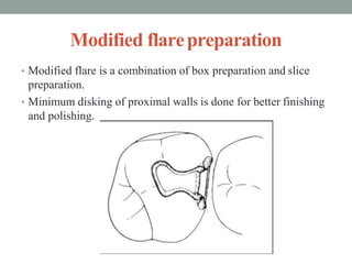 Modified flarepreparation
• Modified flare is a combination of box preparation and slice
preparation.
• Minimum disking of proximal walls is done for better finishing
and polishing.
 