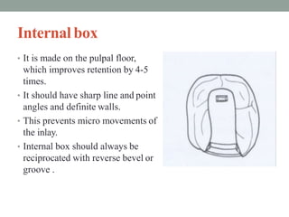 Internalbox
• It is made on the pulpal floor,
which improves retention by 4-5
times.
• It should have sharp line and point
angles and definite walls.
• This prevents micro movements of
the inlay.
• Internal box should always be
reciprocated with reverse bevel or
groove .
 