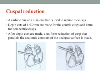 Cuspal reduction
• A carbide bur or a diamond bur is used to reduce the cusps.
• Depth cuts of 1.5-2mm are made for the centric cusps and 1mm
for non centric cusps.
• After depth cuts are made, a uniform reduction of cusp that
parallels the anatomic contours of the occlusal surface is made.
 
