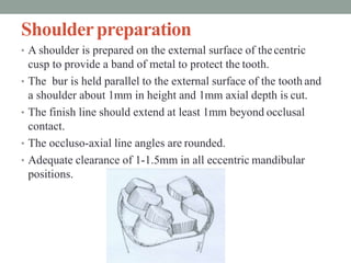 Shoulderpreparation
• A shoulder is prepared on the external surface of thecentric
cusp to provide a band of metal to protect the tooth.
• The bur is held parallel to the external surface of the tooth and
a shoulder about 1mm in height and 1mm axial depth is cut.
• The finish line should extend at least 1mm beyond occlusal
contact.
• The occluso-axial line angles are rounded.
• Adequate clearance of 1-1.5mm in all eccentric mandibular
positions.
 