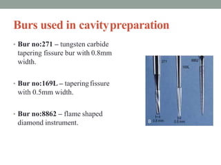 Burs used in cavitypreparation
• Bur no:271 – tungsten carbide
tapering fissure bur with 0.8mm
width.
• Bur no:169L – tape...