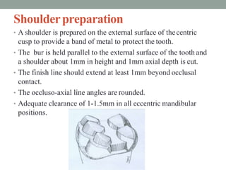 Shoulderpreparation
• A shoulder is prepared on the external surface of thecentric
cusp to provide a band of metal to prot...