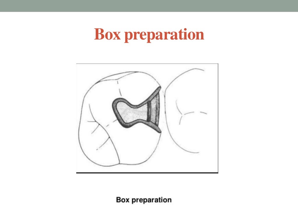Cavity preparation for cast metal restorations